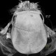 Epidural hematoma, subarachoid hemorrhage, cerebral contusion, skull fissure: CT - Computed tomography